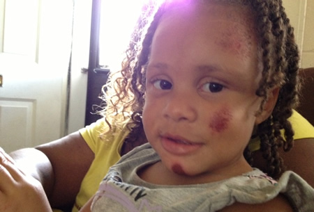 3-year-old recovering after being hit by a car in Norfolk | 13newsnow.com