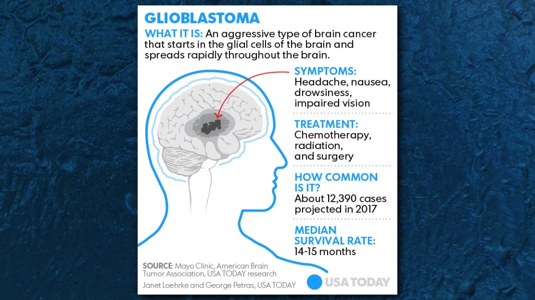 John McCain's cancer What is glioblastoma?